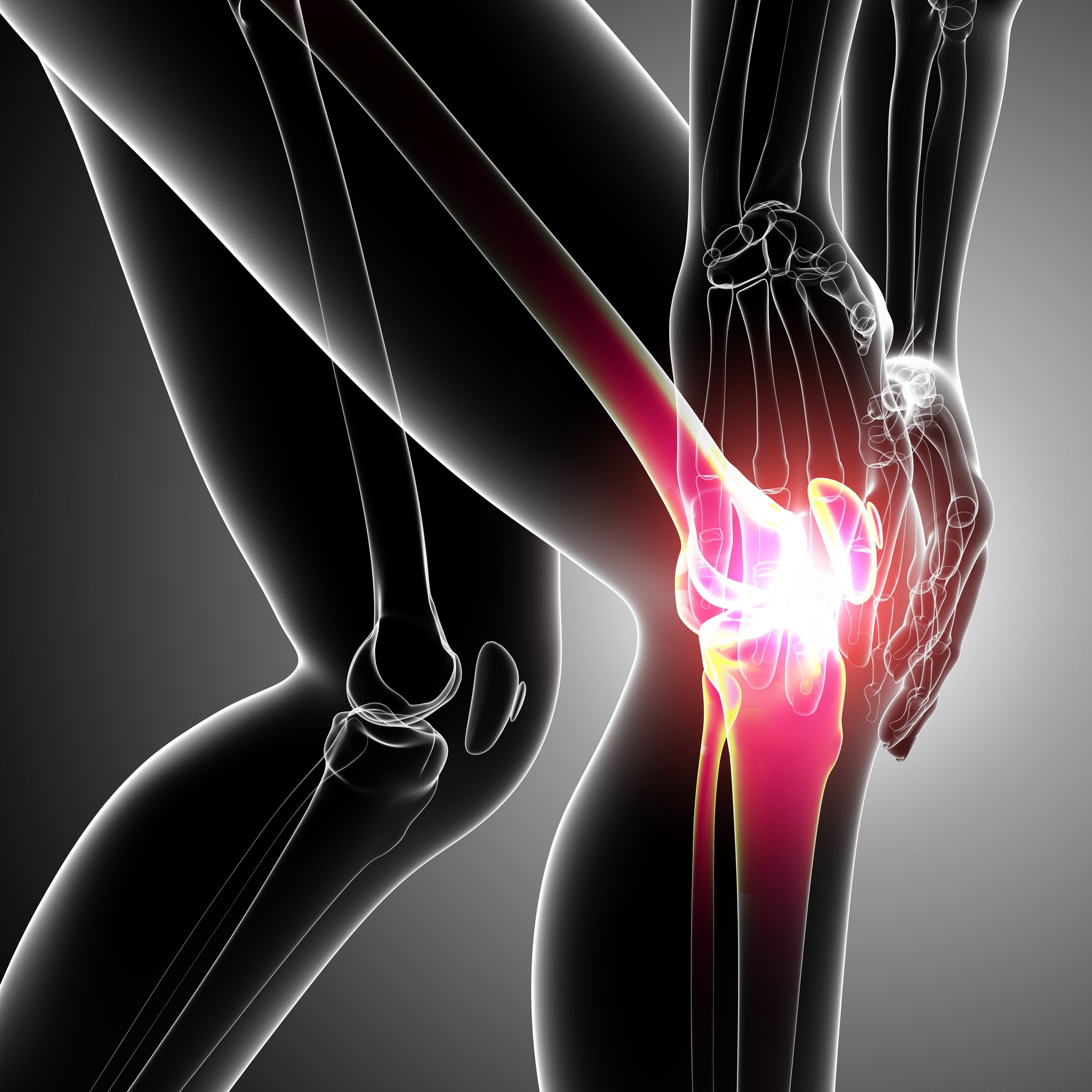 The Use Of Ablation In Knee Pain Management