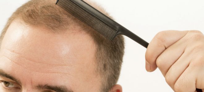 Make A Change in Your Appearance With A Hair Transplant in NY